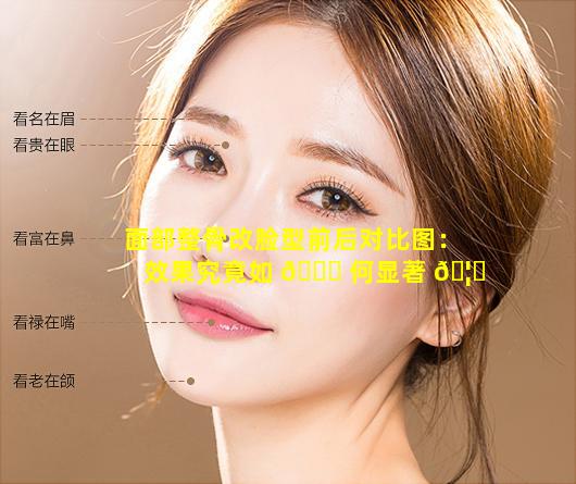 面部整骨改脸型前后对比图：效果究竟如 💐 何显著 🦁